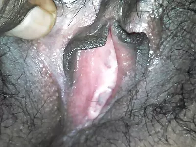 Garter Stuck To Mature
